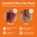 Hot Spot & Itch Relief Skin Cream for Dogs & Cats | Fast & Lasting Relief | Treats the Source | Natural Ingredients & Co