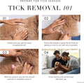 Tweezerman Pet Tick Removal Tweezer, Tick Removal Tool for Dogs and Cats